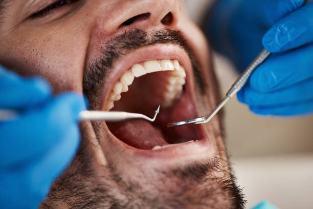 Best Emergency Dentist for Knocked-Out Tooth in Flower Mound, TX